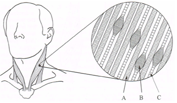 Trigger points on neck